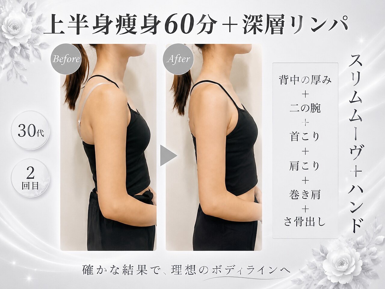 東京おすすめ痩身エステ　エモーション (3)