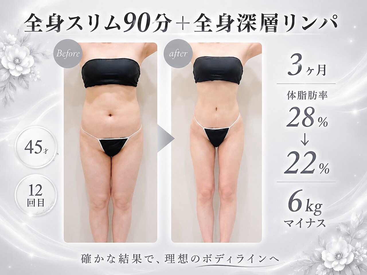 東京おすすめ痩身エステ　エモーション (2)